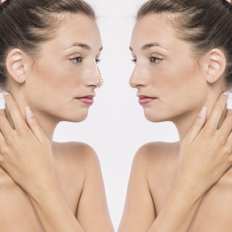 Difference Between Surgical & Non-Surgical Face Lifts